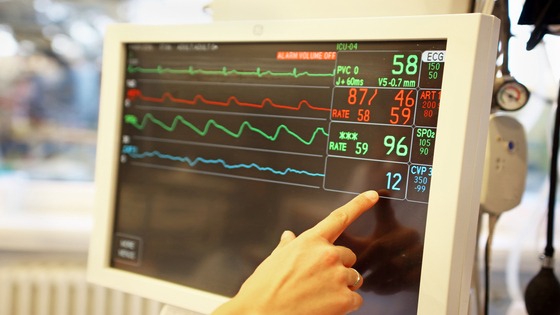 EKG